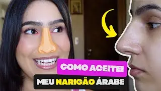 COMO EU ACEITEI O MEU NARIZ - APRENDI A AMAR MINHAS ORIGENS