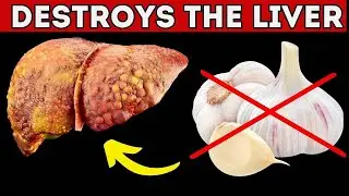 These 10 Foods Are Destroying Your LIVER: The Main ENEMIES of Your Liver We Constantly Consume.