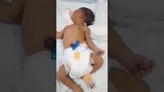 🌟 Tiny Fighter in NICU | Newborn Baby&rsquo;s Brave First Days 💕 #Shorts #nicubaby #shorts
