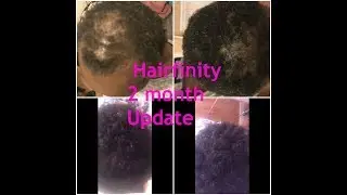 Hairfinity vitamins 2 month update
