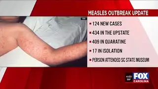 Over 100 new cases confirmed in Upstate measles outbreak