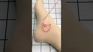 🧵 Fix Torn Stockings Like a Pro! #Darning #StockingRepair #DIYHacks#ytshorts# trending