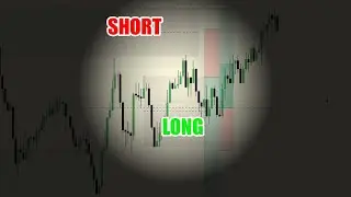 Sometimes I Get Blinded And Forget To Trade Both Sides #11