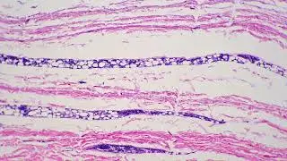 Microscopic 100x view of human skin with shown sweat glands against bright field