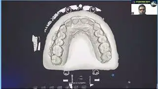 Applications of CAD CAM in Prosthodontics