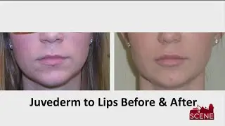How to Get Bigger Lips and Tighter Skin