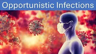 What are Opportunistic infections? Understanding Risks and Prevention