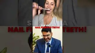She used Nail Filer for teeth | Never do this | Indian Dentist Reacts
