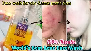 Bnb derma acne free face wash | Acne clear face wash | Acne treatment at home | pimples removal