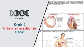 Krok 2 Internal Medicine 2023 Base
