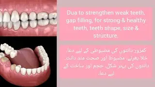 Dua to strengthen weak teeth, gap filling, for strong & healthy teeth, teeth shape, size & structure
