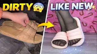 I Cleaned the Dirtiest Rubber Slippers&hellip; INSANE RESULT 🤯 DIRTY ➜ LIKE NEW 😱 #cleaning #dirtytoclean