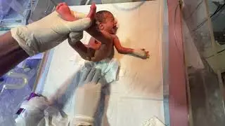 Baby Diaper Change & Feeding Time | Daily Baby Care 👶🍼
