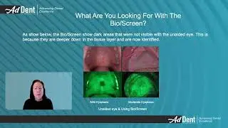 How Bio Screen Oral Exam Light helps grow your practice   #addent