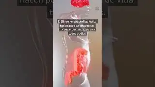 El colon irritable es m&aacute;s com&uacute;n de lo que crees y muchos no saben que lo tienen. #salud #bienestar