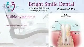 Smile Makeover