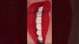 Are you ready to elevate your smile game? 💋