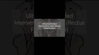 Ultrasound Guided Interventions: Cases (Rectus Femoris Injury) #ultrasound