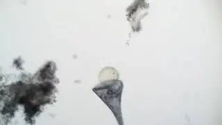 Stentor coeruleus VS. Volvox globator