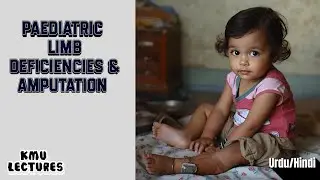 Pediatric Limb Deficiencies/Amputation: Surgical Options & Physical Therapy Management