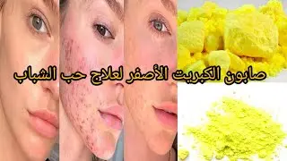 صابون الكبريت الأصفر احسن حل لعلاج حب الشباب 
