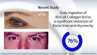 Food Scientist Dr. Taylor Wallace on BioCell Collagen Supplement