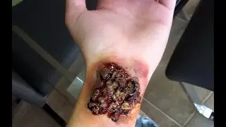 Rotting Skin Tutorial!