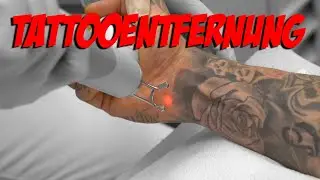 Tattooentfernung |  VALE TUDO