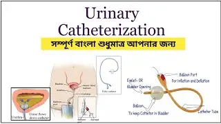 🎬 Urinary Catheterization/ Procedure/ Bengali/ Catheterization in Bengali