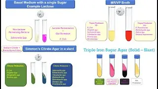 Biochemical Identification of Bacteria