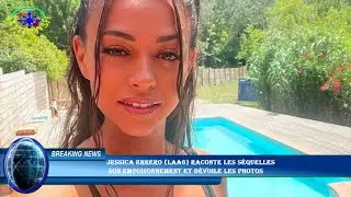 Jessica Errero (LAA6) raconte les s&eacute;quelles  son empoisonnement et d&eacute;voile les photos