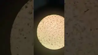 #charcoal #colgatebox  seen under #microscope