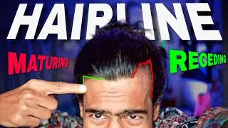 receding VS maturing HAIRLINE (90% Men Don't Know) | Kya mai GANJA hone wala hu?