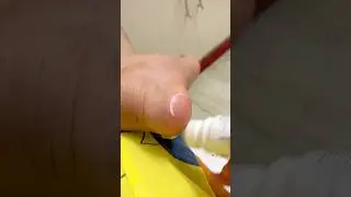 Cracked heels solution bebodywise foot roll on