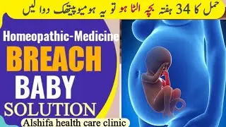Ulta Baby Reham main sidha kerny ki homeopathic medicine| Breech Baby Movements 34 weeks@ahcchealth