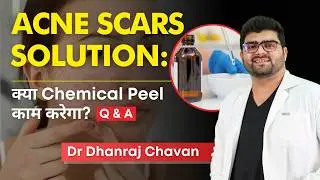 Acne Scars Solution: क्या Chemical Peel काम करेगा?  | Can Phenol Peels Fix Acne Scars?&nbsp;|&nbsp;Clear&nbsp;Skin