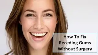 Nature's Smile Review - Fix Receding Gums Without Surgery