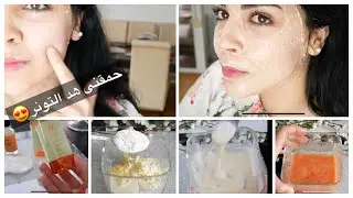 حرقاتك الشمس ديال الصيف 🌚🌞 تلات ماسكات تفتتيح ونضارة كتشعشع