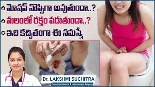 మలంలో రక్తం పడితే | Common Symptoms Of Anal Fissures | Anal Fissure Treatment | Sankhya Hospitals