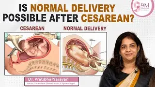 Is Vaginal Birth Possible After Cesarean Delivery? || VBAC || Dr. Pratibha Narayan || 9M Hospitals