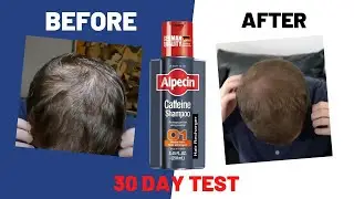 Alpecin Caffeine Shampoo C1 #madeingermany #hair#shampoo#hairtreatment#hairstyles#skin#skincare