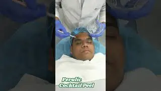 &ldquo;Ferulic, Glycolic & Kojic Peel Review | Real Results for Melasma & Skin Rejuvenation&rdquo;