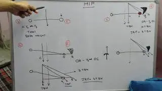 Biomechanics of Hip joint