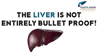 Liver Transplantation Solution to Diseases like Fatty Liver, Liver Cancer, Ascites, Hepatitis?