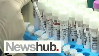 Experts sound alarm, issue warning over 'perilous' state of medical lab workforce | Newshub