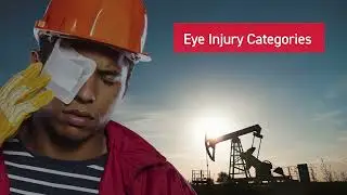 Eye Safety Video Production