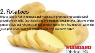 In 60 Seconds: 5 Simple home remedies for Stretchmarks