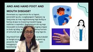 Balat Basics ni Doktora Derma: May Hand Foot and Mouth Disease si Hannah (by Dr Cecile C. Ocampo)