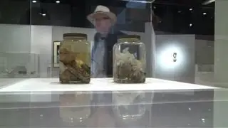 Famous brains on show in London