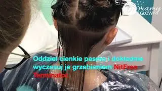 ZWALCZANIE WSZAWICY W PRAKTYCE - jak skutecznie usunąć wszy i gnidy - najlepsza instrukcja!